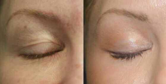 Take care of the areas near the eye