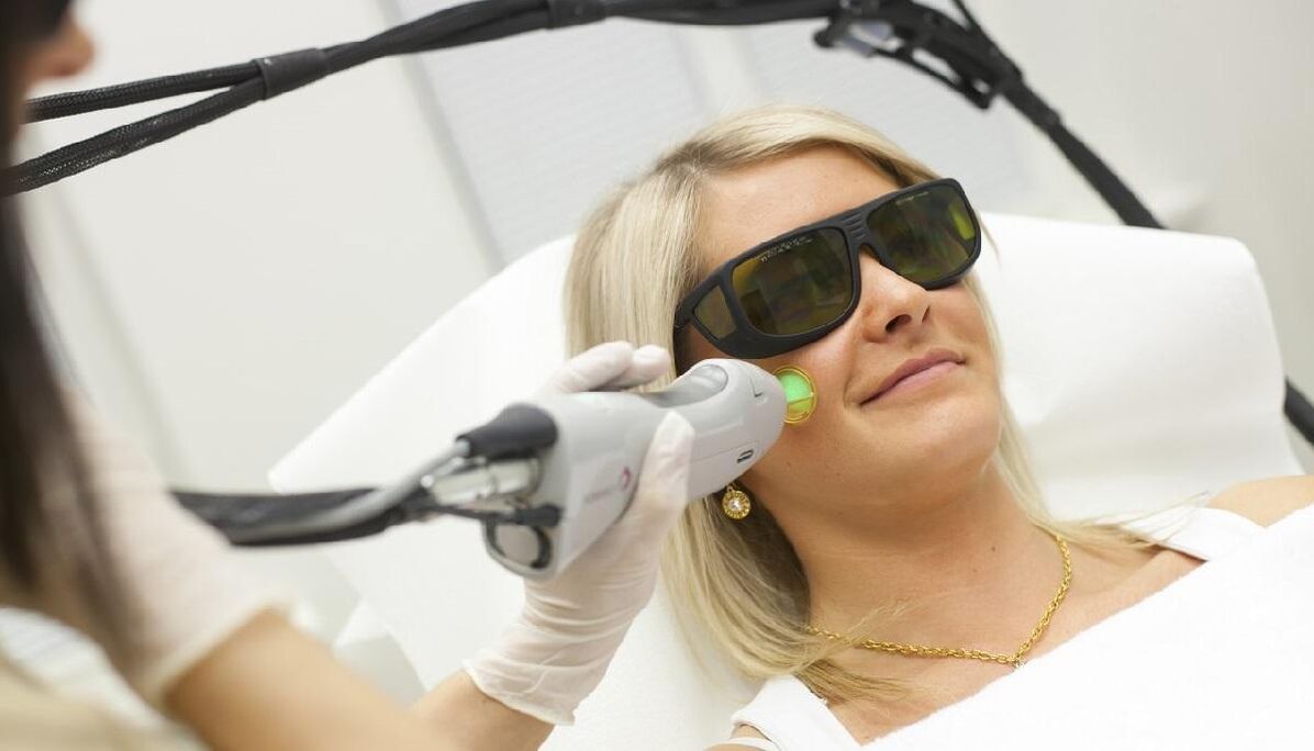 Laser rejuvenation