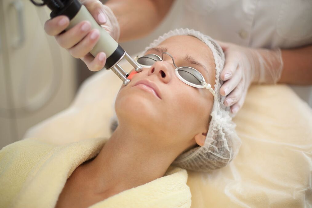 Laser renewal of the skin