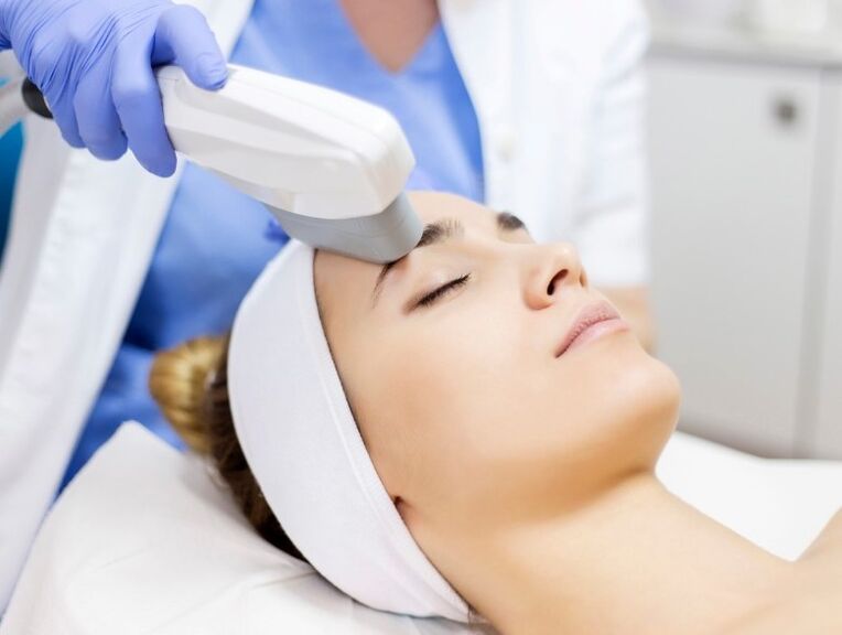 Laser renewal of the skin