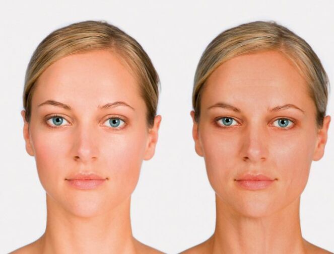 face after and before renewal